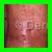 Skin image